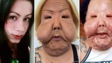Após cirurgia para remoção de óleo mineral, Juju do Pix relata boa recuperação e otimismo para o futuro - Imagem: Reprodução/G1