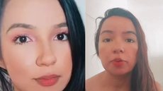 Karine Lima teve o rosto desconfigurado após realizar um procedimento estético chamado Bichectomia. - Imagem: reprodução I Instagram @kacau.r