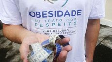 Secretaria de Saúde do Rio combate preconceitos sobre obesidade