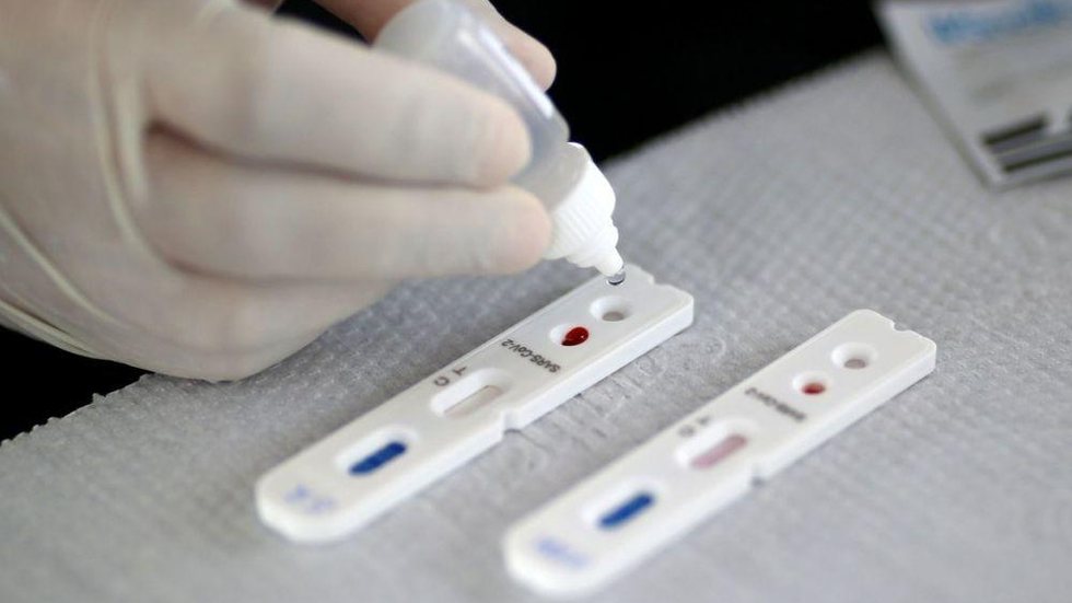 Japão quer aprovar antiviral para o tratamento de coronavírus