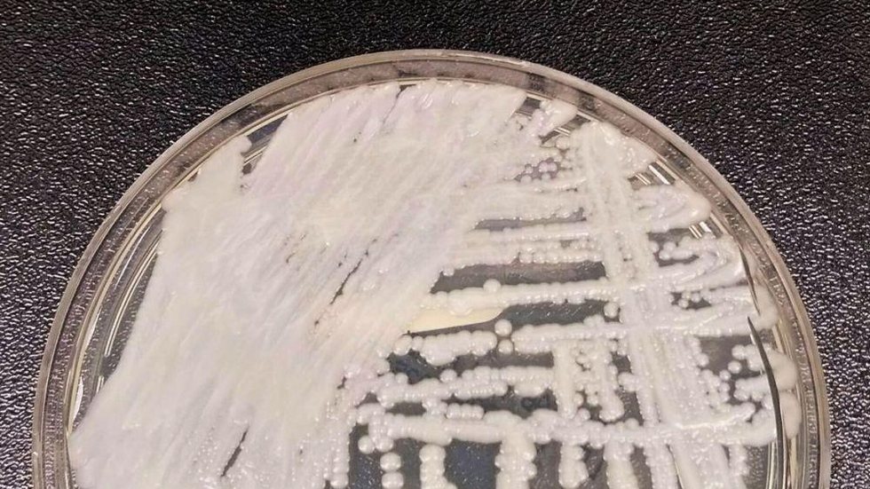 Confirmado segundo caso de Candida auris em PE