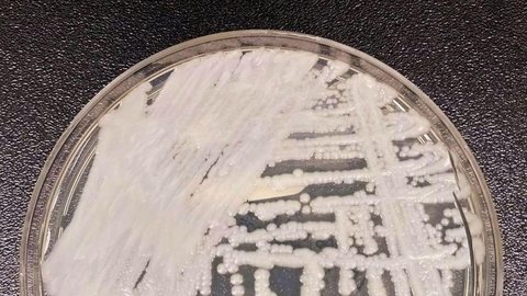 Confirmado segundo caso de Candida auris em PE