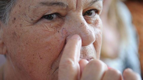 Pandemia impede diagnóstico precoce de câncer de pele