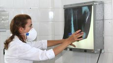 Ministério aprova novas tecnologias para combate à tuberculose no SUS