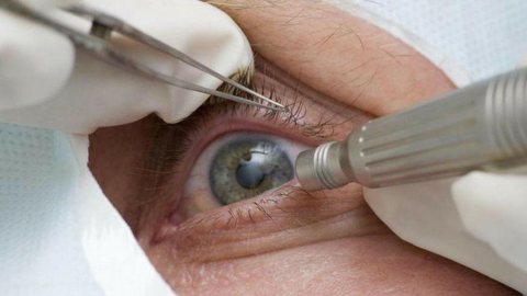 Guia tenta evitar expansão de casos de cegueira por glaucoma