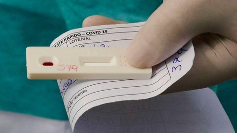 SP está fazendo 8 mil testes para diagnóstico de coronavírus por dia