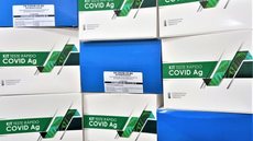 Cidade de SP recebe 350 mil testes rápidos para Covid-19 na rede pública; demanda continua alta