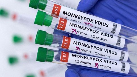 Imagem Casos de varíola dos macacos chegam a 76 em todo o país