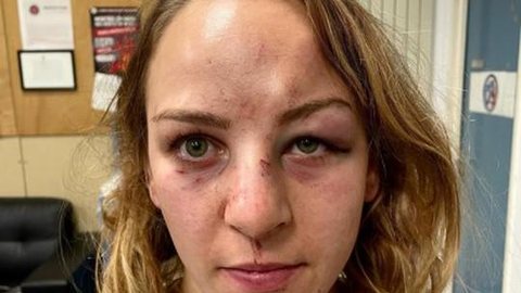 Judoca francesa ouro em Tóquio mostra rosto machucado e acusa técnico de agressão