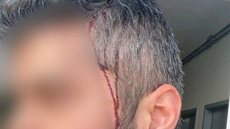 Sobrinho de Bolsonaro é acusado de espancar e morder atual namorado da ex