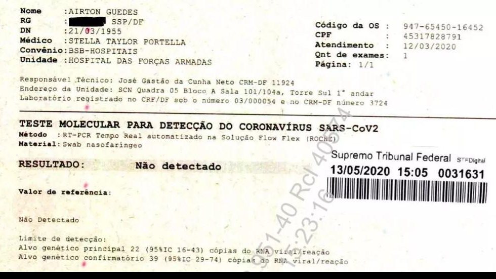 Exames de Bolsonaro deram negativo para coronavírus