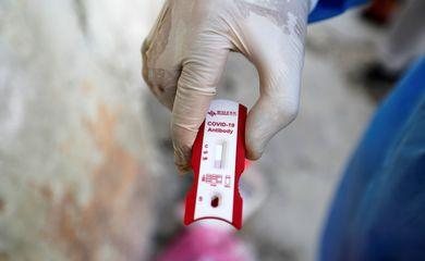 Governo anuncia parceria para produzir vacina contra covid-19