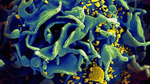 Estudo aponta resultados ‘encorajadores’ de vacina experimental contra HIV