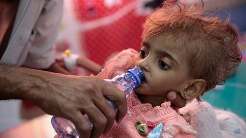 Fome e doenças mataram quase 85 mil crianças no Iêmen desde 2015, diz ONG