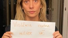 Luisa Mell destitui advogado e diz que ele pediu prisão do ex-marido sem autorização dela; advogado nega