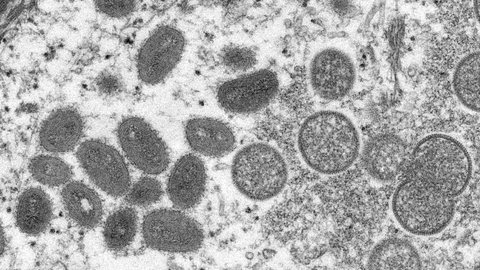 Imagem Fiocruz conclui sequenciamento genético do vírus monkeypox