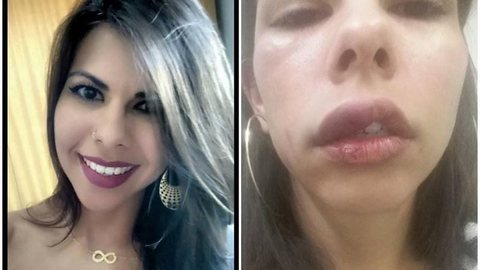 ‘Só o tempo vai curar’, diz vendedora que postou fotos após apanhar do namorado