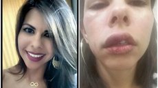 ‘Só o tempo vai curar’, diz vendedora que postou fotos após apanhar do namorado