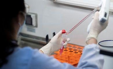 Anvisa pede cautela no uso de plasma de curados em infectados por Covid-19
