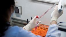 Anvisa pede cautela no uso de plasma de curados em infectados por Covid-19
