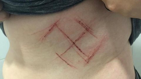 Jovem é agredida e marcada com canivete por vestir camiseta com ‘ele não’ em Porto Alegre