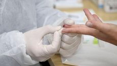 Hospital em SP separa laboratório para casos de reinfecção de covid-19