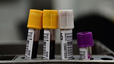 Hemorio inicia testes com plasma sanguíneo no tratamento de covid-19