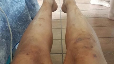 ‘Poderia ter morrido’, diz jovem que foi espancada em festa universitária