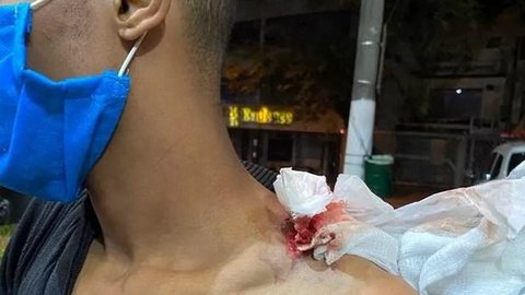 PMs são investigados por atirar bala de borracha na boca de ambulante em SP