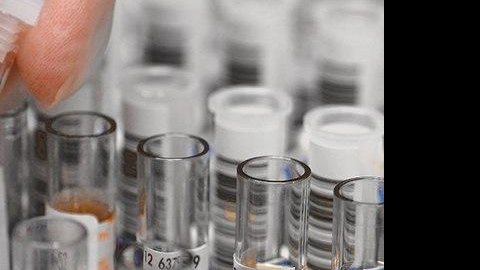 Empresa lança teste de anticorpos para Covid-19 no Reino Unido