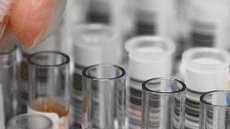 Empresa lança teste de anticorpos para Covid-19 no Reino Unido