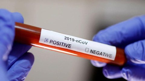 Novo coronavírus causa segunda morte nos Estados Unidos