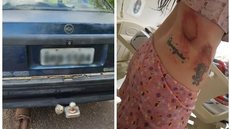 Imagens mostram ferimentos de mulher que foi amarrada por namorado em engate de carro e arrastada