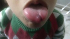 Família registra ocorrência após menino deixar creche Chafic Balura com a língua cortada