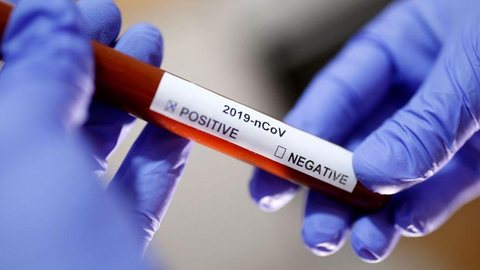 Brasil confirma sete casos de coronavírus