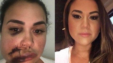 Mulher relata agressão em restaurante de São Paulo: “Copo jogado no meu rosto”