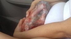 Mulher faz próprio parto e bebê nasce em bolsa amniótica intacta