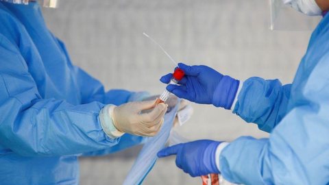 Governo do Japão vai realizar testes de anticorpos para coronavírus