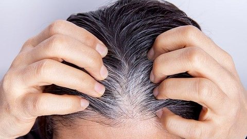 Não é mito: o estresse pode ser a causa dos seus cabelos brancos!