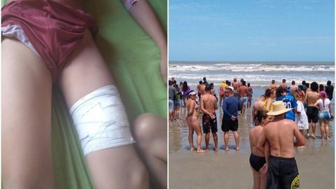 Menino de 11 anos é ferido por tubarão, e animal provoca pânico em praia de SP