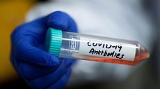 Cientistas testam remédio que reduz 94% da carga viral da covid-19
