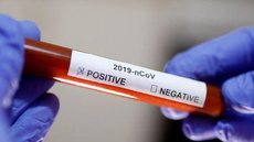 Rio de Janeiro tem segundo caso confirmado do novo coronavírus