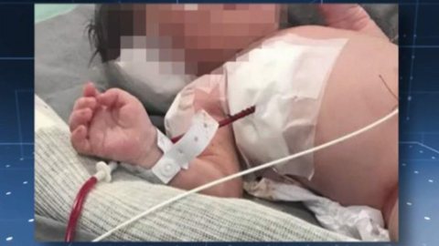Bebê baleado no útero da mãe pode recuperar movimentos, diz médico