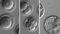 Pesquisadores corrigem genes defeituosos em embriões humanos
