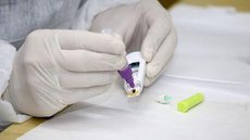 Brasil registra 3,8 milhões de casos de coronavírus