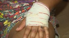 Dona de casa é ferida por companheiro com serra elétrica em Mirassol