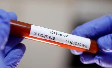 Ministério da Saúde confirma segundo caso de coronavírus no Brasil