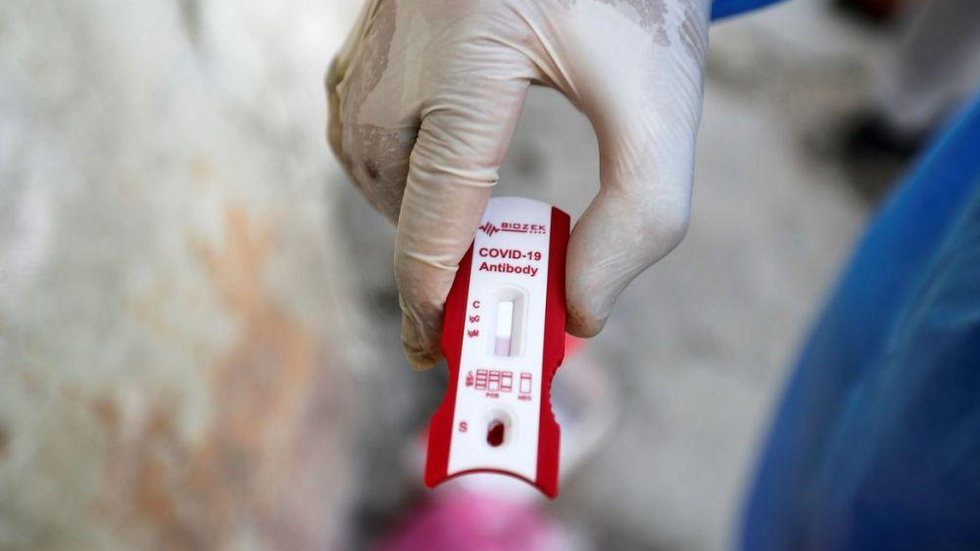 São Paulo amplia testagem do novo coronavírus em áreas vulneráveis