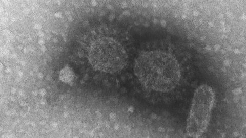 Nova variante do novo coronavírus é identificada no estado do Rio