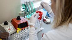 Número de casos do novo coronavírus chega a 13 no Brasil
